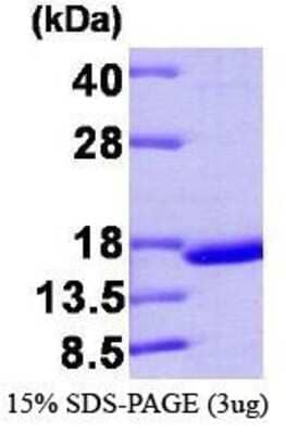 SDS-PAGE: Recombinant Human Transthyretin/Prealbumin Protein [NBP1-37075]