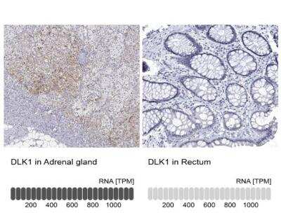 Immunohistochemistry-Paraffin: Pref-1/DLK1/FA1 Antibody [NBP2-32358]