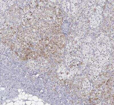 Immunohistochemistry-Paraffin: Pref-1/DLK1/FA1 Antibody [NBP2-32358]