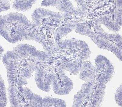 Immunohistochemistry-Paraffin: Pref-1/DLK1/FA1 Antibody [NBP2-32358]