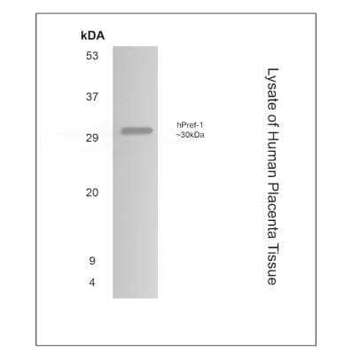 Western Blot: Pref-1/DLK1/FA1 Antibody (MM0514-9D8)Azide and BSA Free [NBP2-11855]