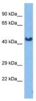 Western Blot: Pregnancy Specific beta-1-glycoprotein 7 Antibody [NBP3-09982]