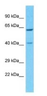 Western Blot: Pregnancy Specific beta-1-glycoprotein 8 Antibody [NBP3-09221]