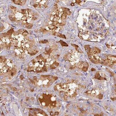 Immunohistochemistry-Paraffin: Pregnancy Zone Protein Antibody [NBP1-85489]