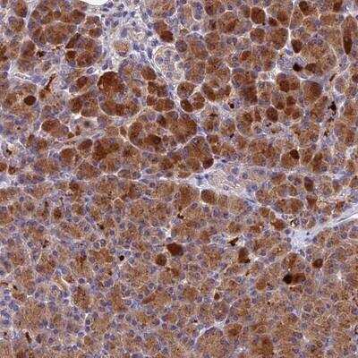 Immunohistochemistry-Paraffin: Pregnancy Zone Protein Antibody [NBP1-85490]