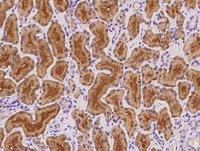 Immunohistochemistry-Paraffin: Pregnancy Zone Protein Antibody [NBP2-97150]