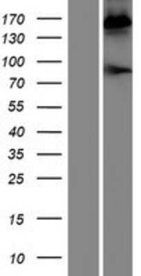 Western Blot: Pregnancy Zone Protein Overexpression Lysate [NBP2-10853]