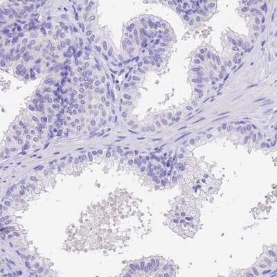 Immunohistochemistry-Paraffin: Pregnancy specific beta 1 glycoprotein 11 Antibody [NBP1-87795]