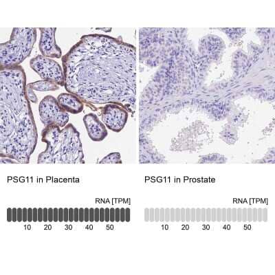 Immunohistochemistry-Paraffin: Pregnancy specific beta 1 glycoprotein 11 Antibody [NBP1-87795]