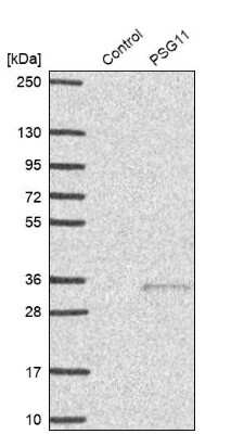 Western Blot: Pregnancy specific beta 1 glycoprotein 11 Antibody [NBP1-87795]