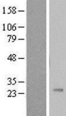 Western Blot: Pregnancy specific beta 1 glycoprotein 11 Overexpression Lysate [NBL1-14864]