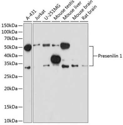 Western Blot: Presenilin-1 Antibody (3W4V8) [NBP3-15665]