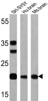 Western Blot: Presenilin-1 Antibody (APS 11) [NB300-749]