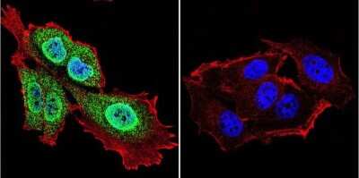 Immunocytochemistry/ Immunofluorescence: Presenilin-1 Antibody (APS 18) [NB100-74510]