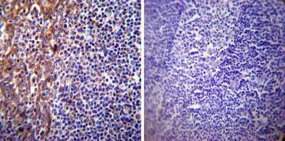 Immunohistochemistry-Paraffin: Presenilin-1 Antibody (APS 18) [NB100-74510]