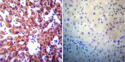 Immunohistochemistry-Paraffin: Presenilin-1 Antibody (APS 18) [NB100-74510]