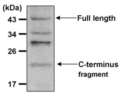 Western Blot: Presenilin-1 Antibody (APS 18) [NB100-74510]