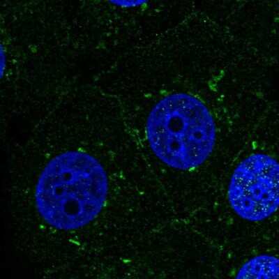 Immunocytochemistry/ Immunofluorescence: Presenilin-1 Antibody [NBP2-57002]