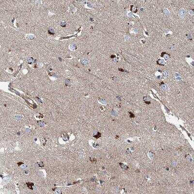 Immunohistochemistry: Presenilin-1 Antibody [NBP1-90245]