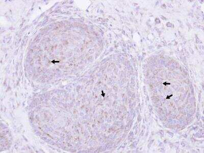 Immunohistochemistry-Paraffin: Presenilin-1 Antibody [NBP1-33611]