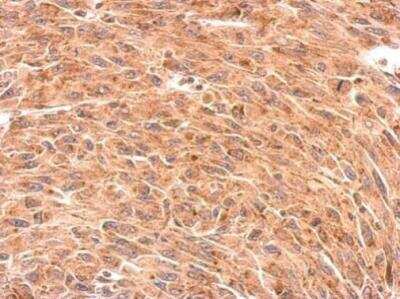 Immunohistochemistry-Paraffin: Presenilin-1 Antibody [NBP1-33611]