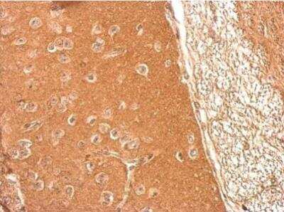 Immunohistochemistry-Paraffin: Presenilin-1 Antibody [NBP1-33611]