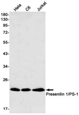 Western Blot: Presenilin-1 Antibody (S05-4D4) [NBP3-15082]