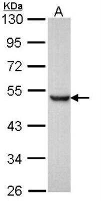 Western Blot: Presenilin-1 Antibody [NBP1-33611]