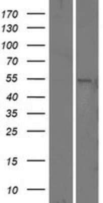 Western Blot: Presenilin-1 Overexpression Lysate [NBL1-14860]