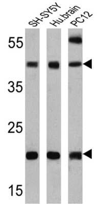 Western Blot: Presenilin-2 Antibody (APS 21) [NB100-74512]