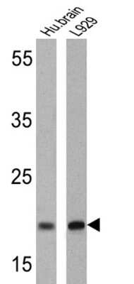 Western Blot: Presenilin-2 Antibody (APS 26) [NB100-74513]