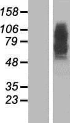 Western Blot: Presenilin-2 Overexpression Lysate [NBP2-10350]