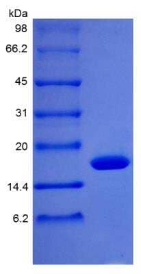 SDS-PAGE: Recombinant Rhesus Macaque G-CSF Protein [NBP2-35297]