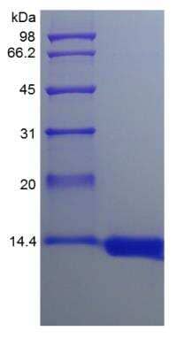 SDS-PAGE: Recombinant Rhesus Macaque GM-CSF Protein [NBP2-35299]