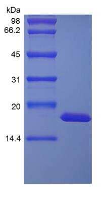 SDS-PAGE: Recombinant Rhesus Macaque IL-1 alpha/IL-1F1 Protein [NBP2-35305]