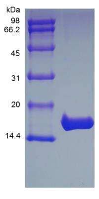 SDS-PAGE: Recombinant Rhesus Macaque IL-1 beta/IL-1F2 Protein [NBP2-35307]