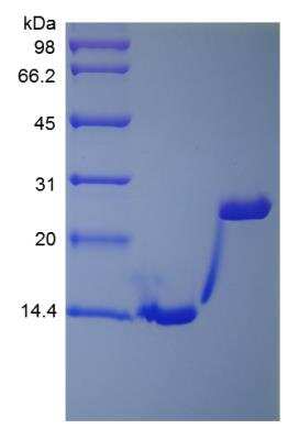 SDS-PAGE: Recombinant Rhesus Macaque IL-5 Protein [NBP2-41387]