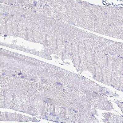 Immunohistochemistry-Paraffin: PrPC Antibody [NBP1-92285]