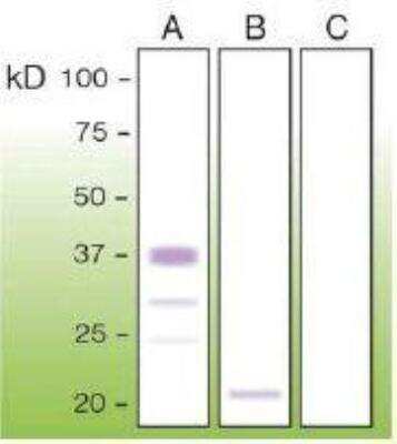 Western Blot: PrPC Antibody (T16-R) [NBP1-71667]