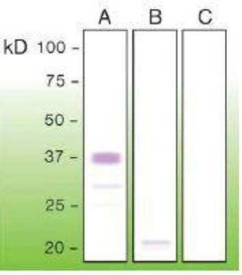Western Blot: PrPSc Antibody (V21-V) [NBP1-71678]