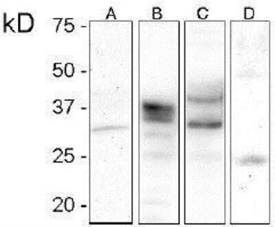 Western Blot: PrPSc Antibody (V21-V) [NBP1-71678]