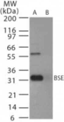 Western Blot: PrPC Antibody [NB100-56605]