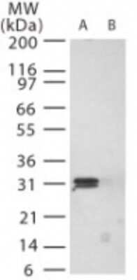 Western Blot: PrPC Antibody [NB100-56606]