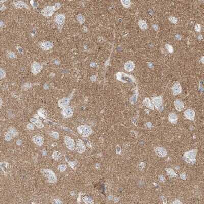 Immunohistochemistry-Paraffin: ProSAPiP1 Antibody [NBP1-91018]