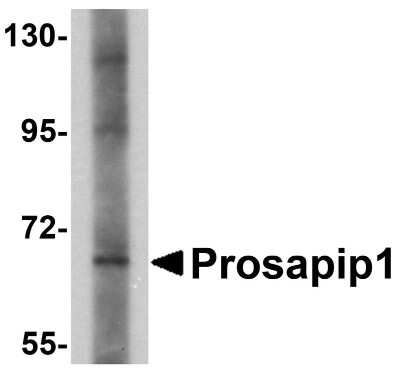 Western Blot: ProSAPiP1 AntibodyBSA Free [NBP1-77369]