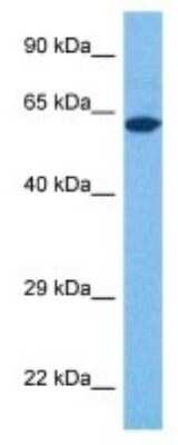 Western Blot: ProSAPiP1 Antibody [NBP3-09992]