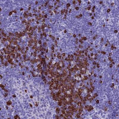 Immunohistochemistry-Paraffin: Proapoptotic Caspase Adaptor Protein Antibody [NBP1-92287]