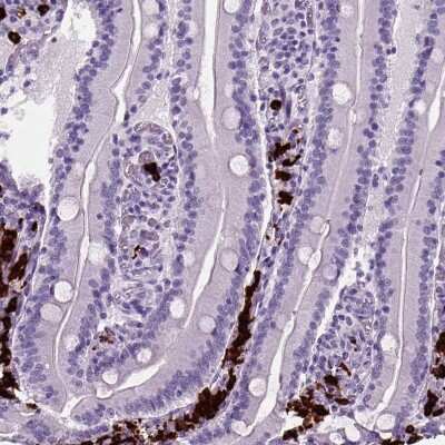 Immunohistochemistry-Paraffin: Proapoptotic Caspase Adaptor Protein Antibody [NBP2-55874]