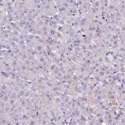 Immunohistochemistry-Paraffin: Proapoptotic Caspase Adaptor Protein Antibody [NBP2-55874]