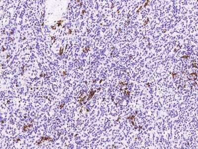 Immunohistochemistry-Paraffin: Proapoptotic Caspase Adaptor Protein Antibody [NBP2-97099]